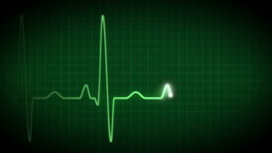 EKG